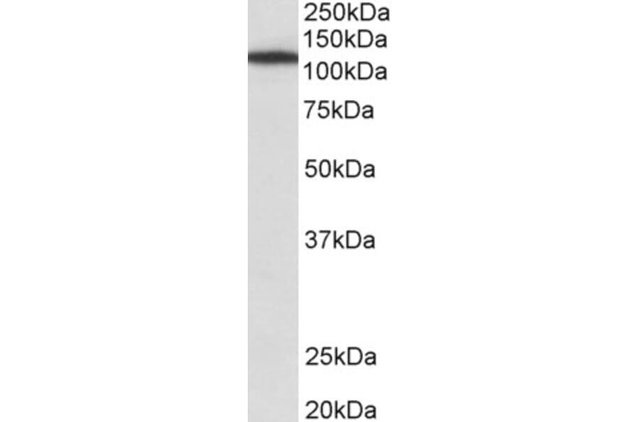 Western Blot - Anti-MYO1B Antibody (A82942) - Antibodies.com