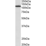 Western Blot - Anti-MYO1B Antibody (A82942) - Antibodies.com