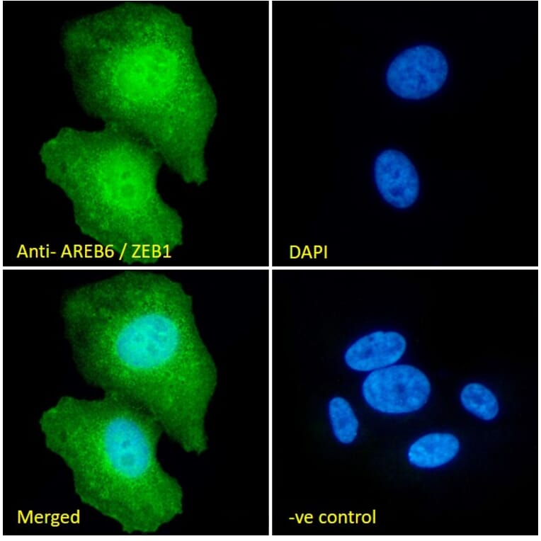 Immunofluorescence - Anti-ZEB1 Antibody (A82943) - Antibodies.com