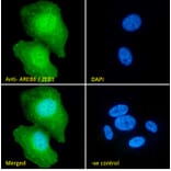 Immunofluorescence - Anti-ZEB1 Antibody (A82943) - Antibodies.com