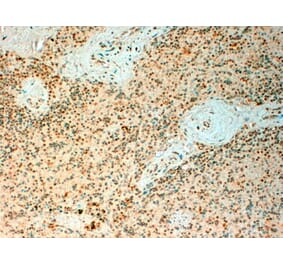 Immunohistochemistry - Anti-Tet2 Antibody (A82944) - Antibodies.com