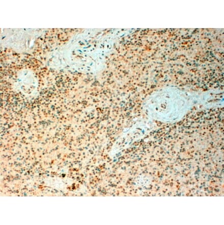 Immunohistochemistry - Anti-Tet2 Antibody (A82944) - Antibodies.com