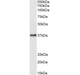 Western Blot - Anti-DARC Antibody (A82945) - Antibodies.com