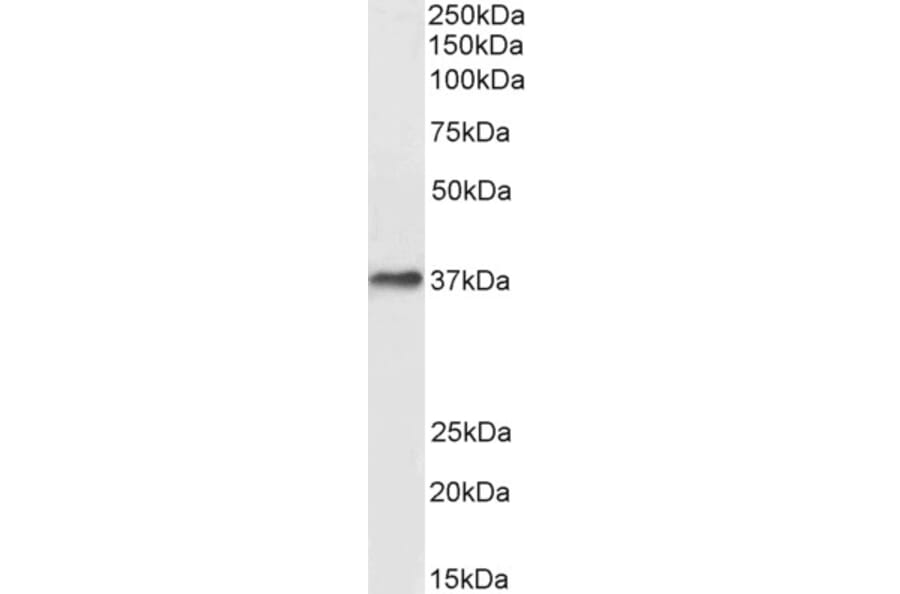 Western Blot - Anti-DARC Antibody (A82945) - Antibodies.com