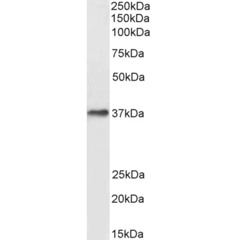 Western Blot - Anti-DARC Antibody (A82945) - Antibodies.com