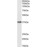 Western Blot - Anti-DARC Antibody (A82945) - Antibodies.com