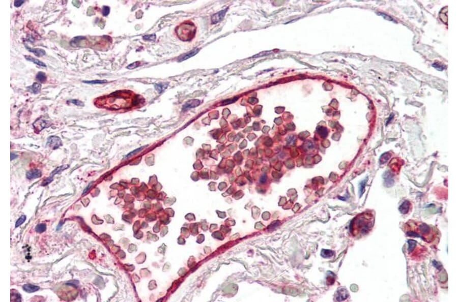 Immunohistochemistry - Anti-DARC Antibody (A82945) - Antibodies.com
