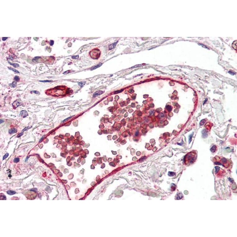 Immunohistochemistry - Anti-DARC Antibody (A82945) - Antibodies.com