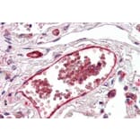 Immunohistochemistry - Anti-DARC Antibody (A82945) - Antibodies.com