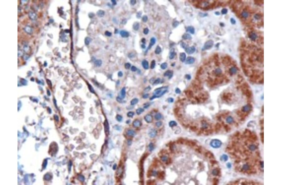 Immunohistochemistry - Anti-DARC Antibody (A82945) - Antibodies.com
