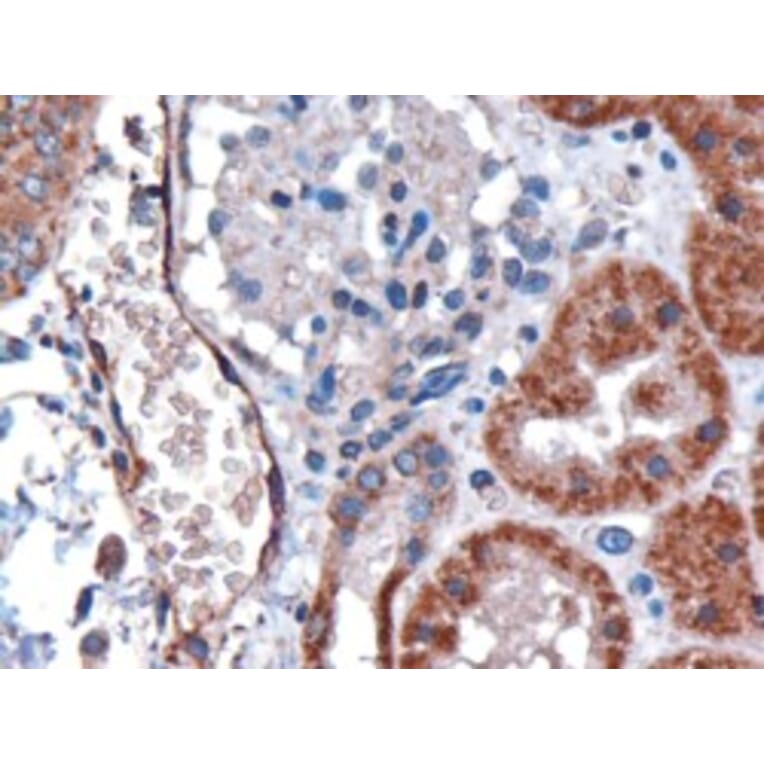 Immunohistochemistry - Anti-DARC Antibody (A82945) - Antibodies.com