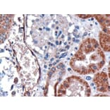Immunohistochemistry - Anti-DARC Antibody (A82945) - Antibodies.com