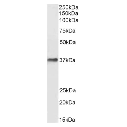 Western Blot - Anti-ACKR1 Antibody (A82945) - Antibodies.com