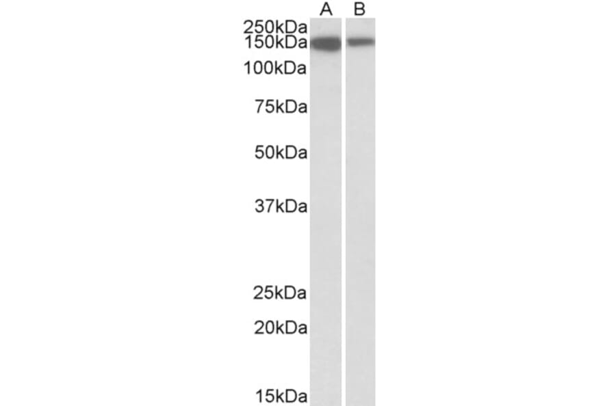 Western Blot - Anti-ARHGEF14 Antibody (A82947) - Antibodies.com