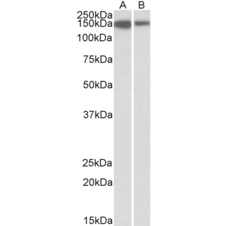 Western Blot - Anti-ARHGEF14 Antibody (A82947) - Antibodies.com