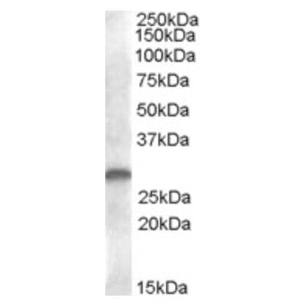 Western Blot - Anti-CLEC-2 Antibody (A82949) - Antibodies.com