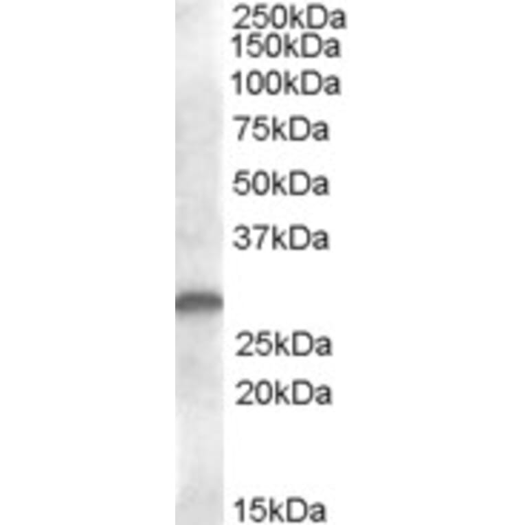 Western Blot - Anti-CLEC-2 Antibody (A82949) - Antibodies.com