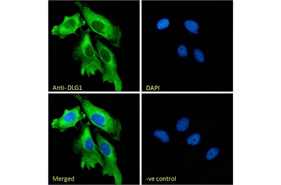 Immunofluorescence - Anti-SAP97 Antibody (A82950) - Antibodies.com