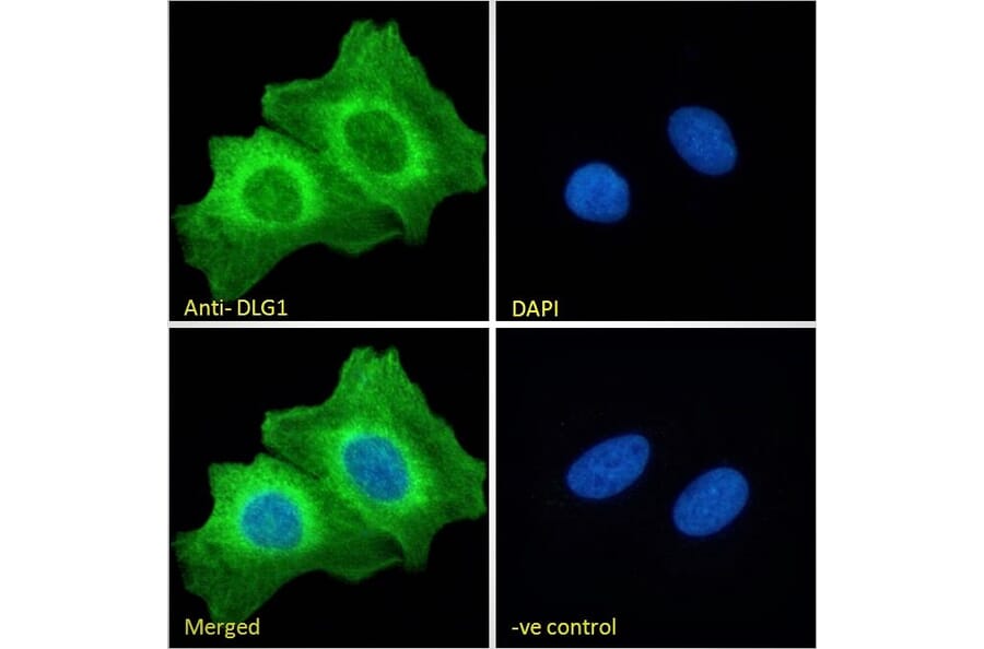 Immunofluorescence - Anti-SAP97 Antibody (A82950) - Antibodies.com