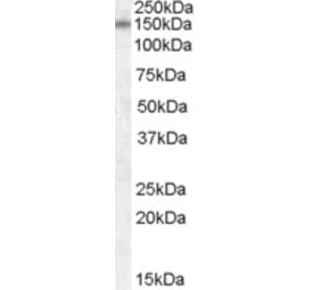 Western Blot - Anti-DLG1 Antibody (A82950) - Antibodies.com