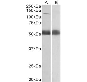 Western Blot - Anti-COPA Antibody (A82951) - Antibodies.com