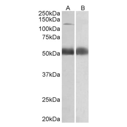 Western Blot - Anti-COPA Antibody (A82951) - Antibodies.com