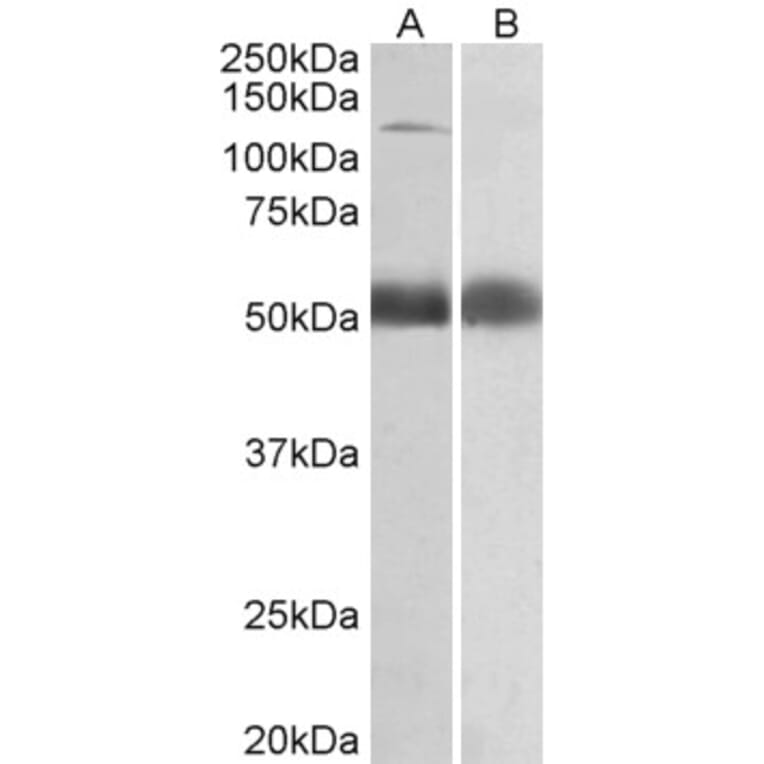 Western Blot - Anti-COPA Antibody (A82951) - Antibodies.com