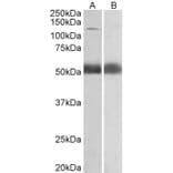 Western Blot - Anti-COPA Antibody (A82951) - Antibodies.com