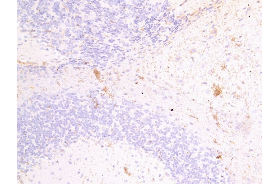 Immunohistochemistry - Anti-Fascin 2 Antibody (A82952) - Antibodies.com