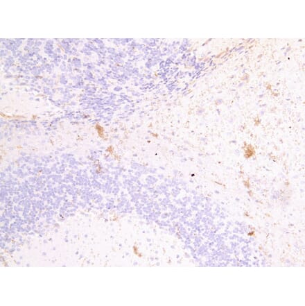 Immunohistochemistry - Anti-Fascin 2 Antibody (A82952) - Antibodies.com