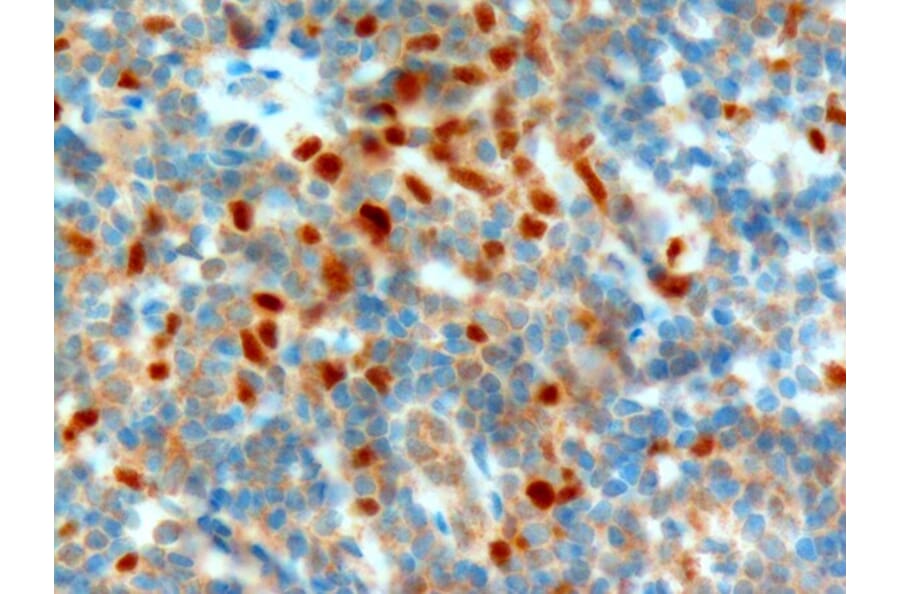 Immunohistochemistry - Anti-NET1 Antibody (A82953) - Antibodies.com