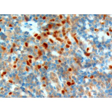 Immunohistochemistry - Anti-NET1 Antibody (A82953) - Antibodies.com