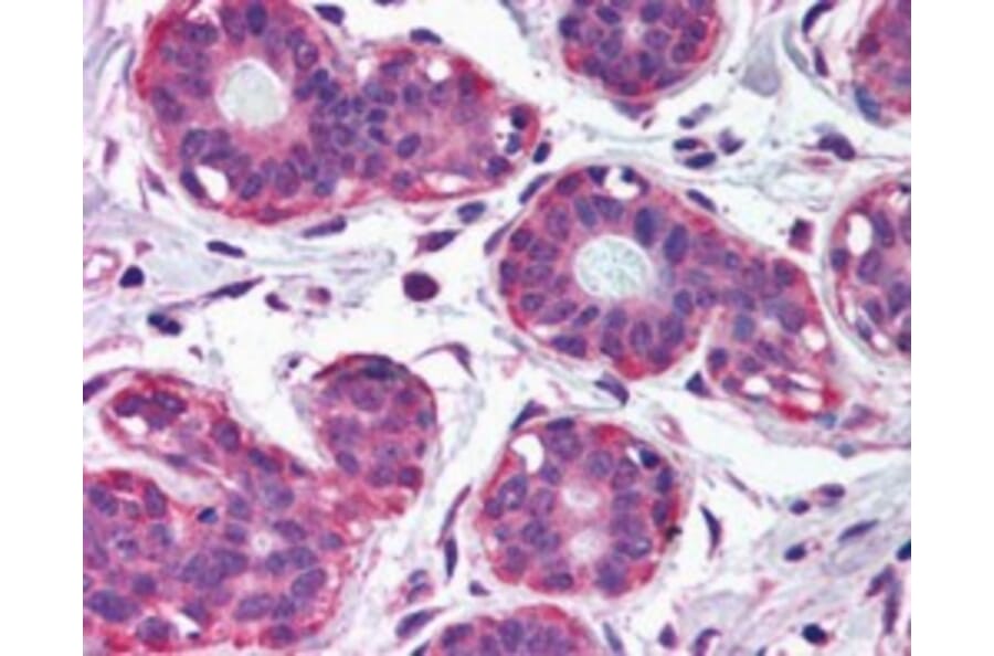 Immunohistochemistry - Anti-NET1 Antibody (A82954) - Antibodies.com