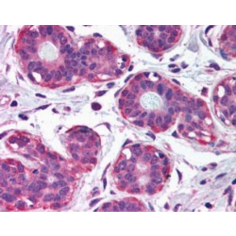 Immunohistochemistry - Anti-NET1 Antibody (A82954) - Antibodies.com