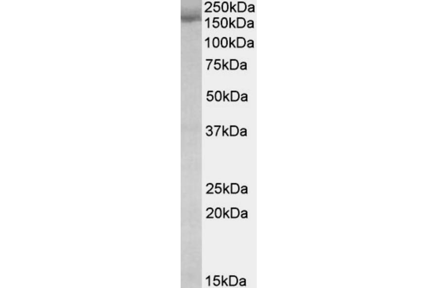 Western Blot - Anti-STAG2 Antibody (A82955) - Antibodies.com