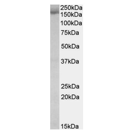 Western Blot - Anti-STAG2 Antibody (A82955) - Antibodies.com