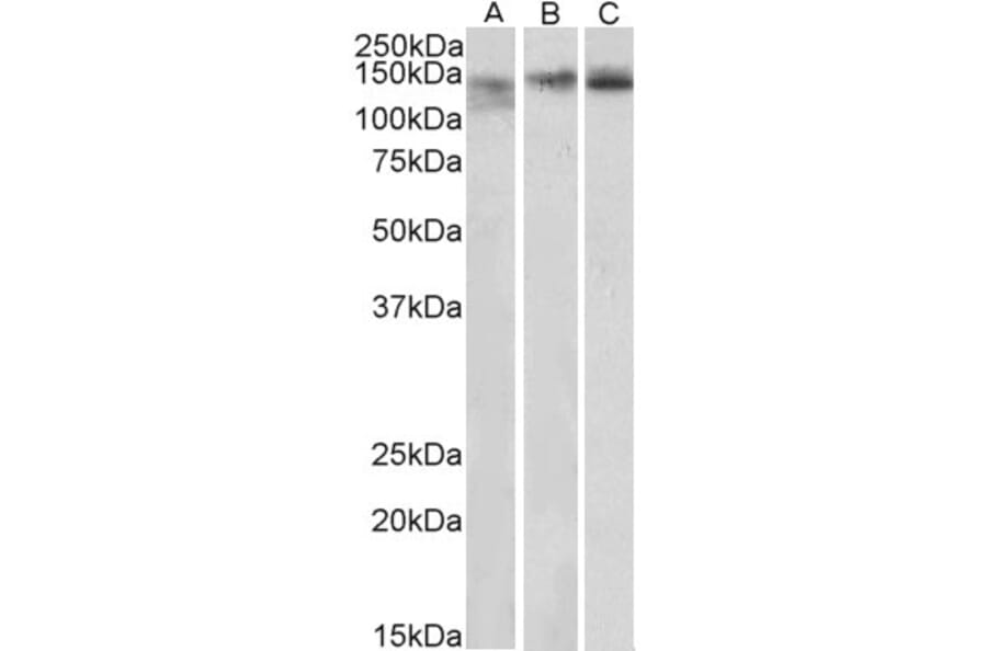 Western Blot - Anti-STAG2 Antibody (A82955) - Antibodies.com