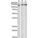 Western Blot - Anti-STAG2 Antibody (A82955) - Antibodies.com