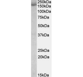 Western Blot - Anti-STAG2 Antibody (A82955) - Antibodies.com