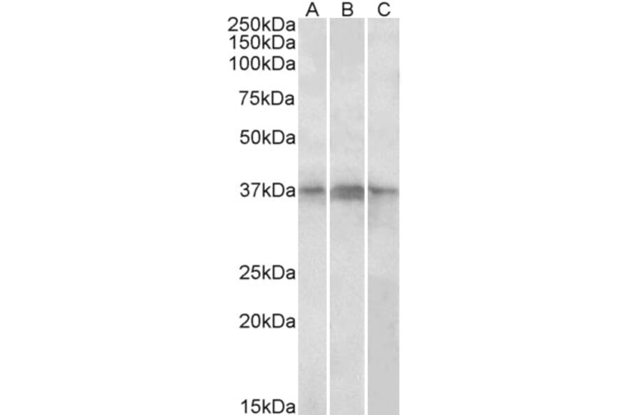 Western Blot - Anti-PHF11 Antibody (A82956) - Antibodies.com