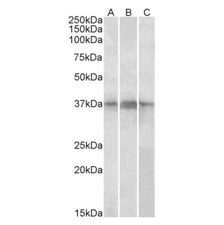 Western Blot - Anti-PHF11 Antibody (A82956) - Antibodies.com