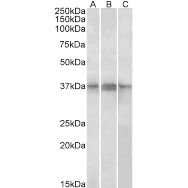 Western Blot - Anti-PHF11 Antibody (A82956) - Antibodies.com