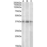 Western Blot - Anti-PHF11 Antibody (A82956) - Antibodies.com