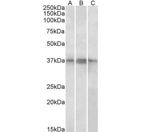 Western Blot - Anti-PHF11 Antibody (A82956) - Antibodies.com
