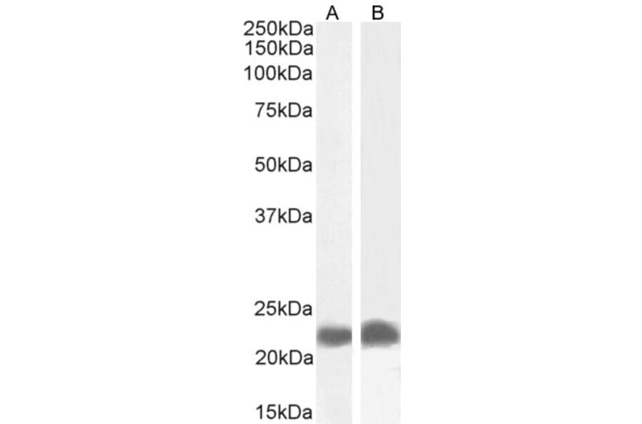 Western Blot - Anti-TIRAP Antibody (A82959) - Antibodies.com