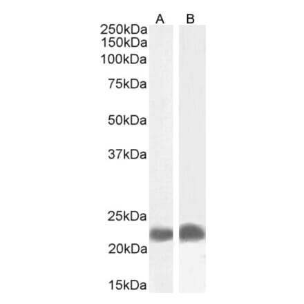 Western Blot - Anti-TIRAP Antibody (A82959) - Antibodies.com