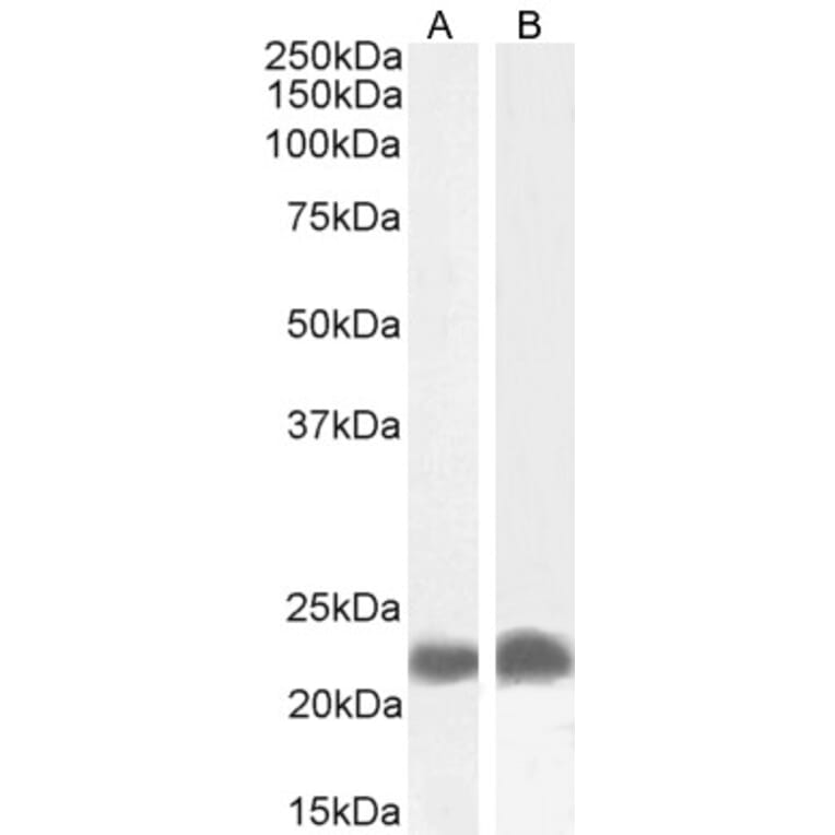 Western Blot - Anti-TIRAP Antibody (A82959) - Antibodies.com