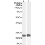 Western Blot - Anti-TIRAP Antibody (A82959) - Antibodies.com