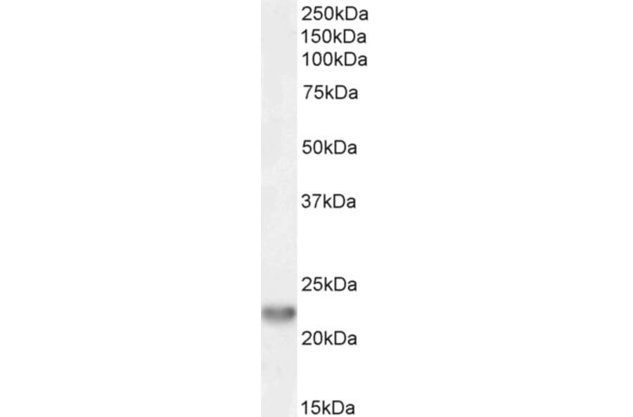 Western Blot - Anti-TIRAP Antibody (A82959) - Antibodies.com