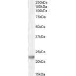 Western Blot - Anti-TIRAP Antibody (A82959) - Antibodies.com